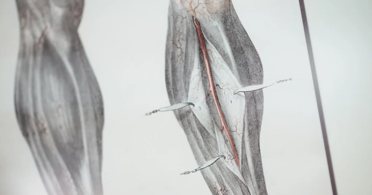 Anatomical illustration showing leg veins and muscles